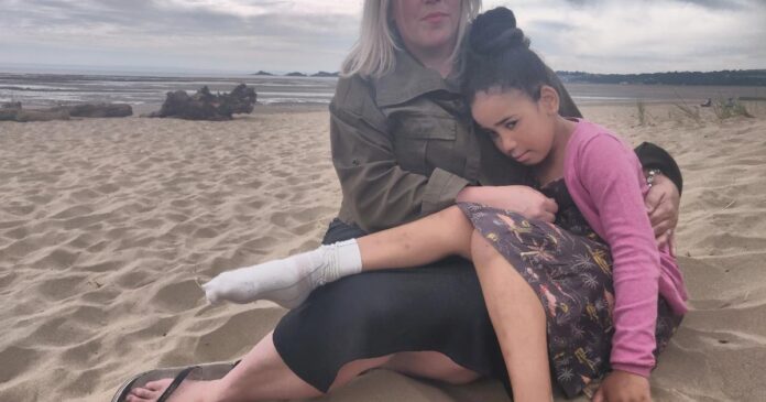 Local girl badly burned by BBQ buried on beach